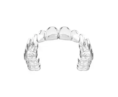 Custom Clear Retainer