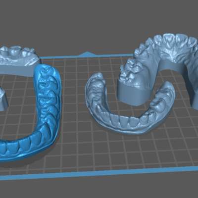 Brain Dental Lab CAD Dental Model - Design Services 13