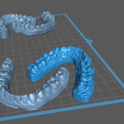 Brain Dental Lab CAD Dental Model - Design Services 9