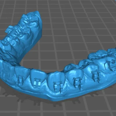 Brain Dental Lab CAD Dental Model - Design Services 2