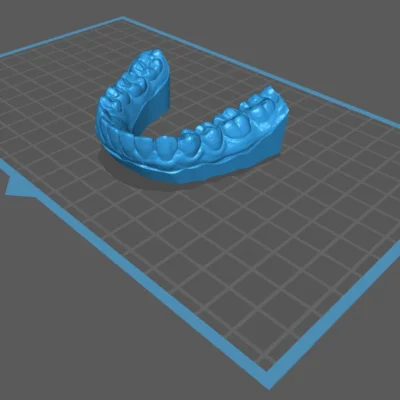 Brain Dental Lab CAD Dental Model - Design Services 3