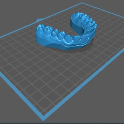 Brain Dental Lab CAD Dental Model - Design Services 4