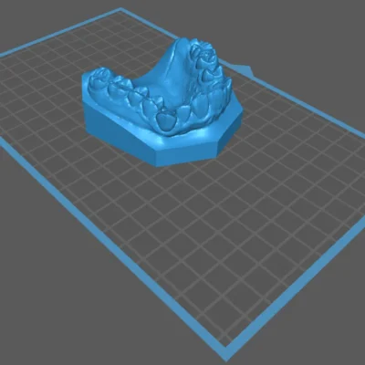 Brain Dental Lab CAD Dental Model - Design Services 5