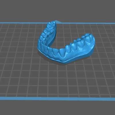 Brain Dental Lab CAD Dental Model - Design Services 7