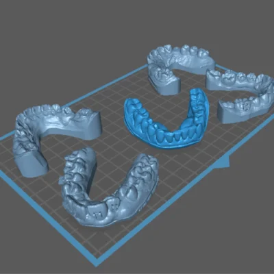 Brain Dental Lab CAD Dental Model - Design Services