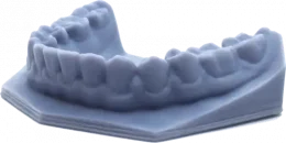 3D-Printed-Dental-Model Dental Study Model
